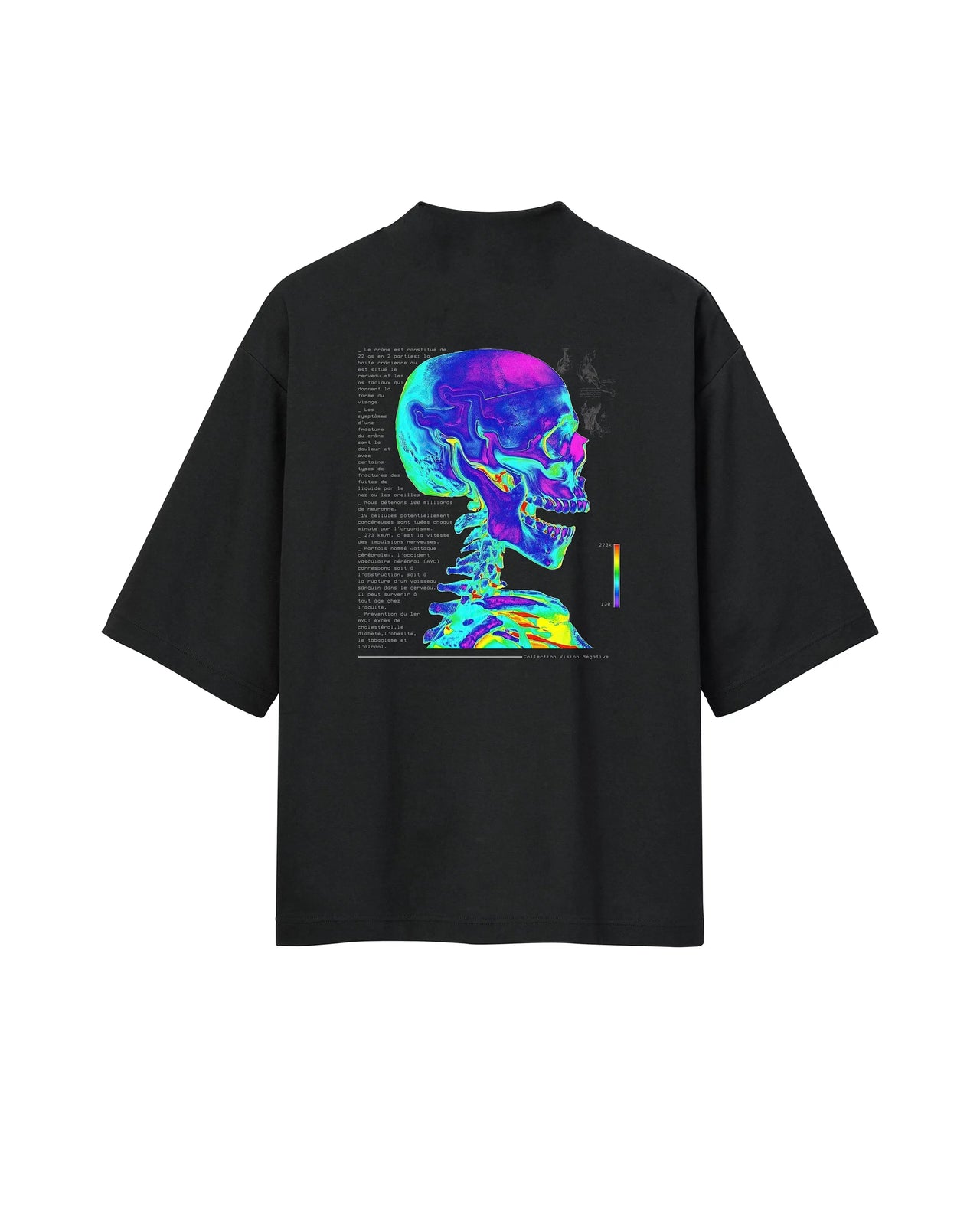 "Autopsie Négative."